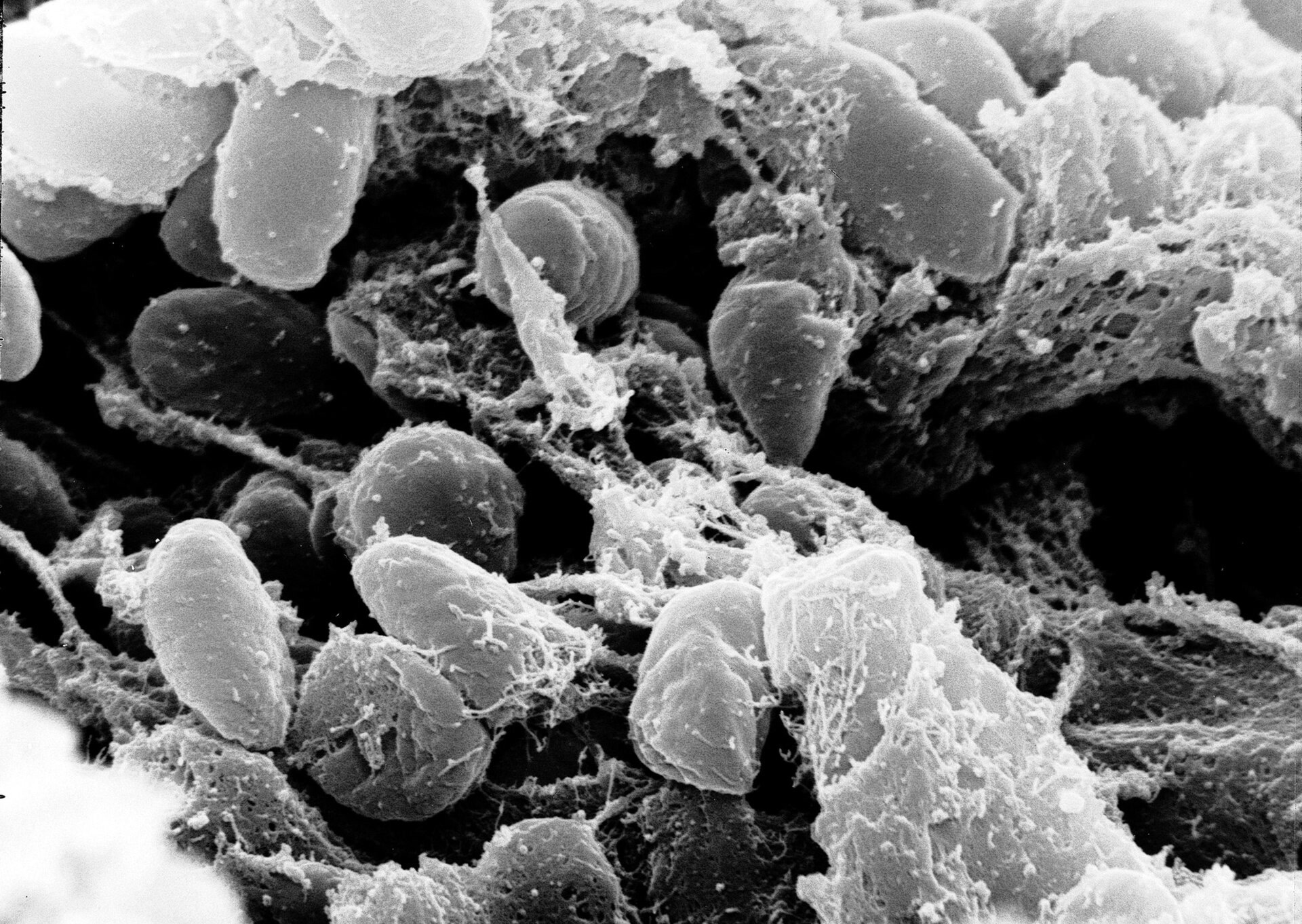 Electron micrograph of Yersinia pestis, the bacterium that causes plague
