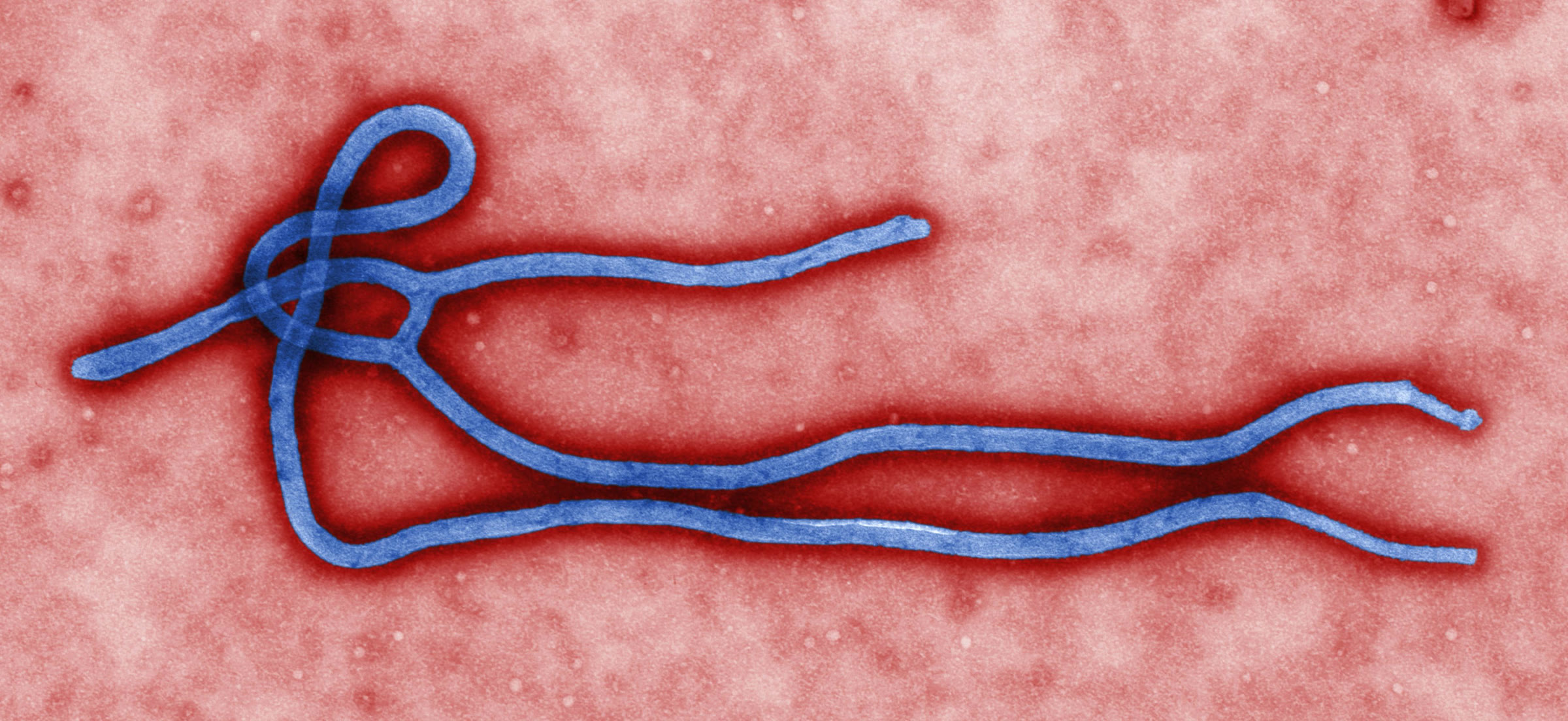 Ebola virus under an electron microscope