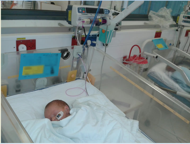 A premature baby in a neonatal intensive care unit (illustrative)